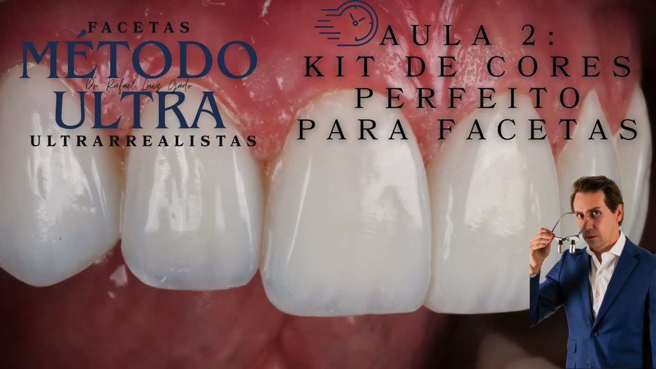 AULA 2 MÉTODO ULTRA= ESCOLHA DE ESPATULAS E RESINAS PARA FACETAS! O KIT PERFEITO