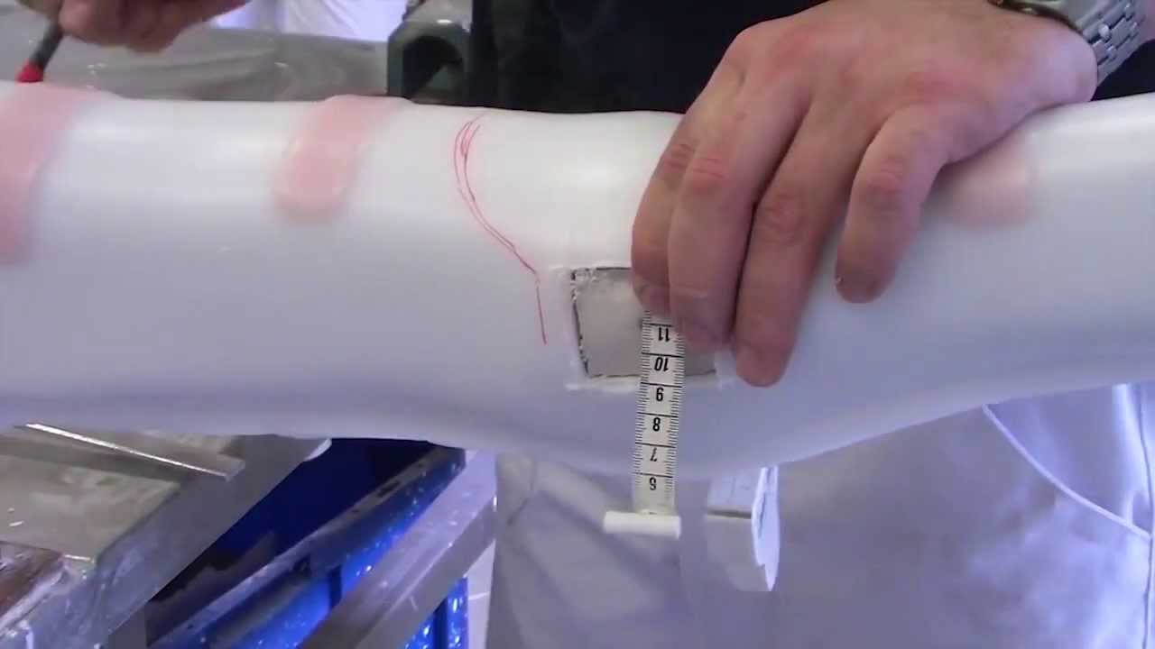 TRAILER Human Study e.V. ISPO Category II Orthotics of the Lower Extremities ENG+ Serbo-Croatian