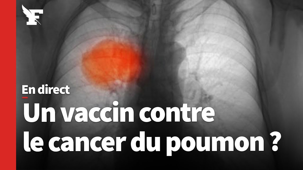 Cancer du poumon: un nouveau vaccin suscite l'espoir