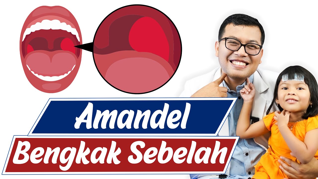Penyebab Amandel Bengkak hanya di satu sisi - DOKTER SADDAM ISMAIL