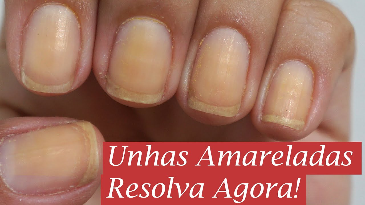 Como tirar Amarelo das Unhas - Dica da Semana