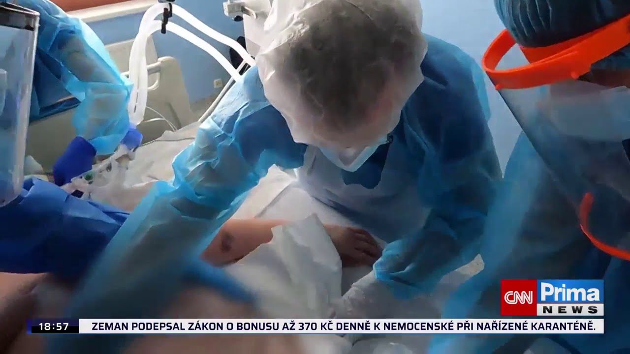 Směna na covid oddělen&iacute; - upozorňujeme, že z&aacute;běry jsou drastick&eacute;