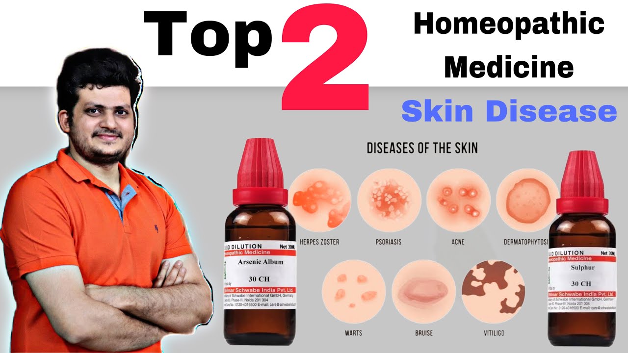 Top 2 Homeopathic Medicine for Skin | चर्म रोग की सबसे बेहतरीन दो होम्योपैथिक दवा |