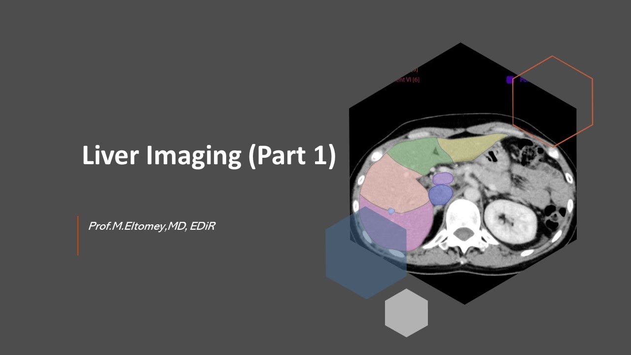 Liver Imaging (Part 1): Methods of Liver Imaging