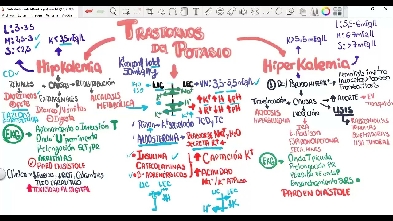 Trastornos del Potasio: Hipopotasemia e Hiperpotasemia (Hipo e hiperKalemia)