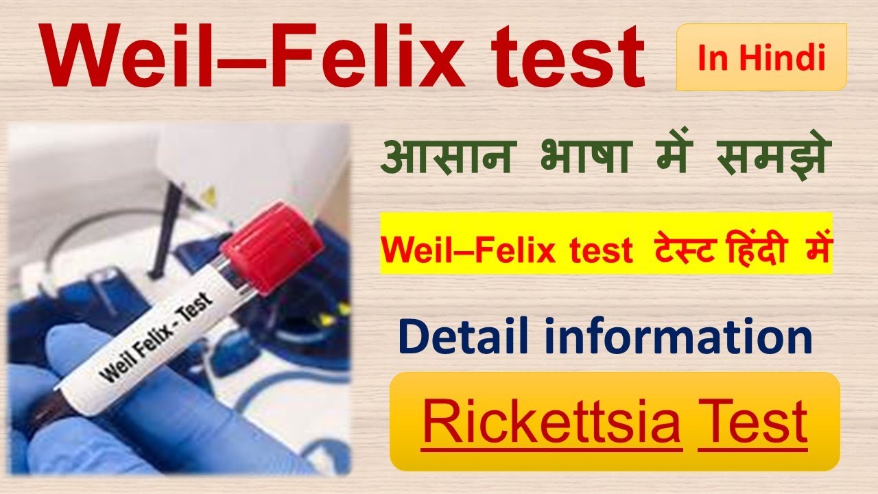 Weil&ndash;Felix test&nbsp;|| Test for Rickettsia  || Detail information in Hindi
