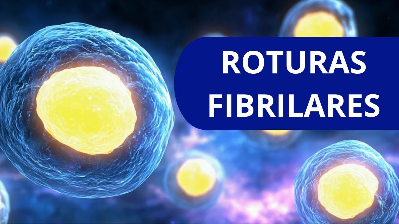 ROTURAS FIBRILARES: Protocolo Acelerado con DIATERMIA / TECARTERAPIA⚡️ GUÍA