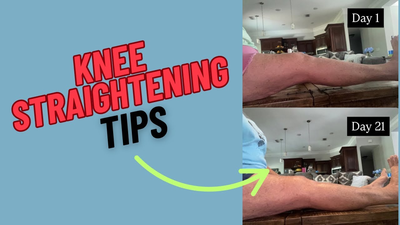 How to Straighten Your Knee After Knee Replacement Surgery | Best Stretching & Strengthening Tips