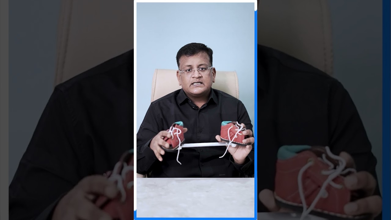Is Clubfoot Curable! Know Everything about Clubfoot, Child Orthopedic Dr Dr. Pushpvbardhn