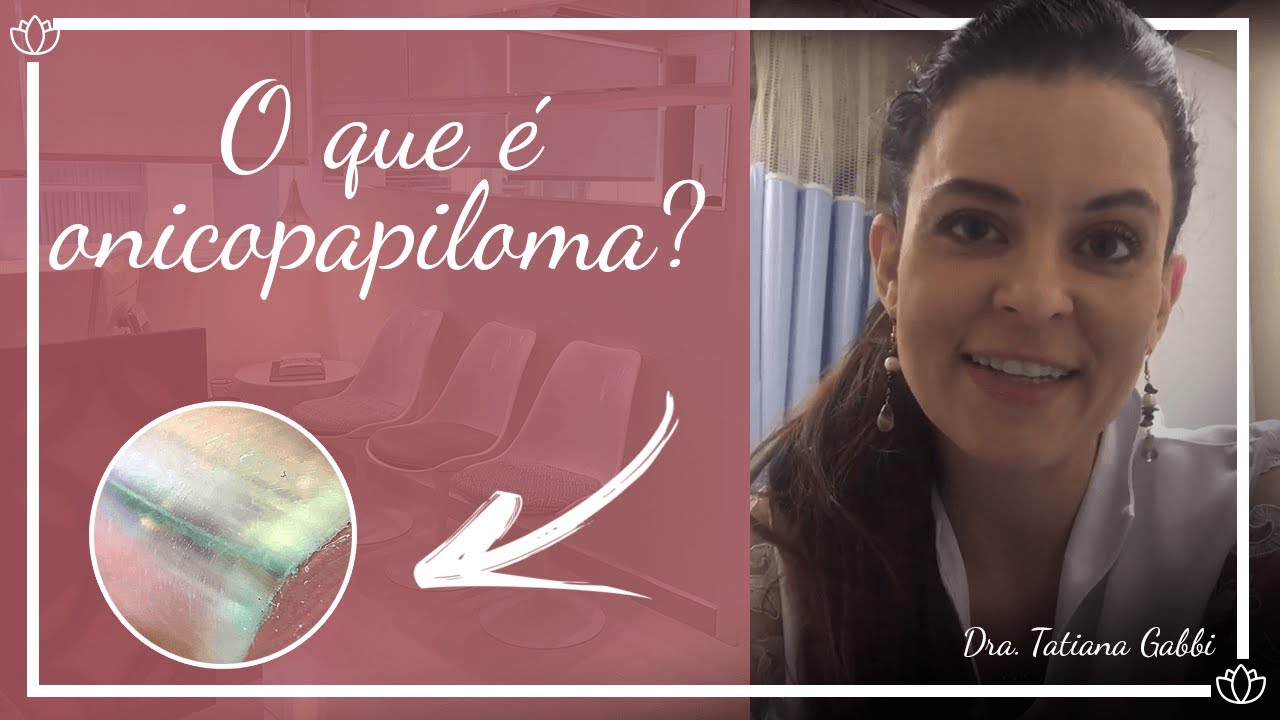 Onicopapiloma