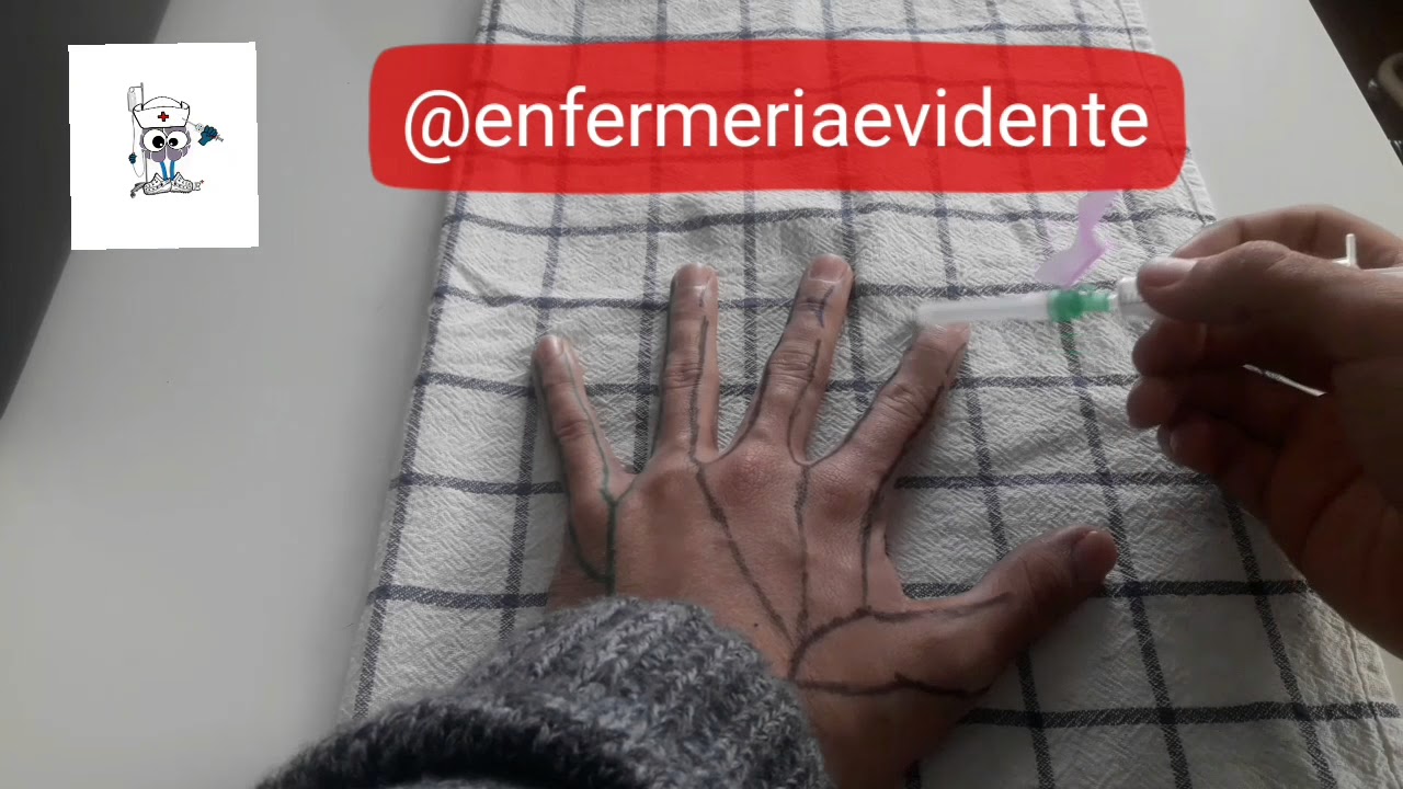 Como dormir un dedo BLOQUEO DIGITAL CON ANESTESIA LOCAL// MAESTROS DE LA SUTURA