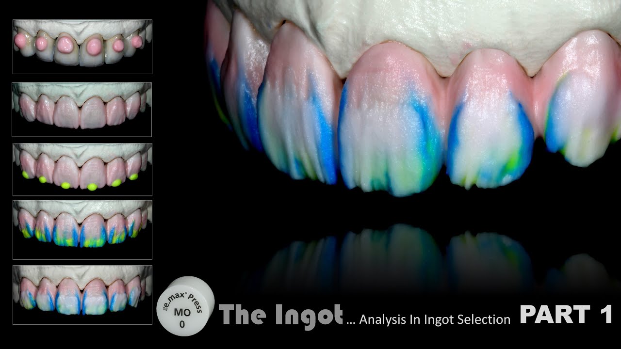 MO0... Analysis in ingot selection PART 1