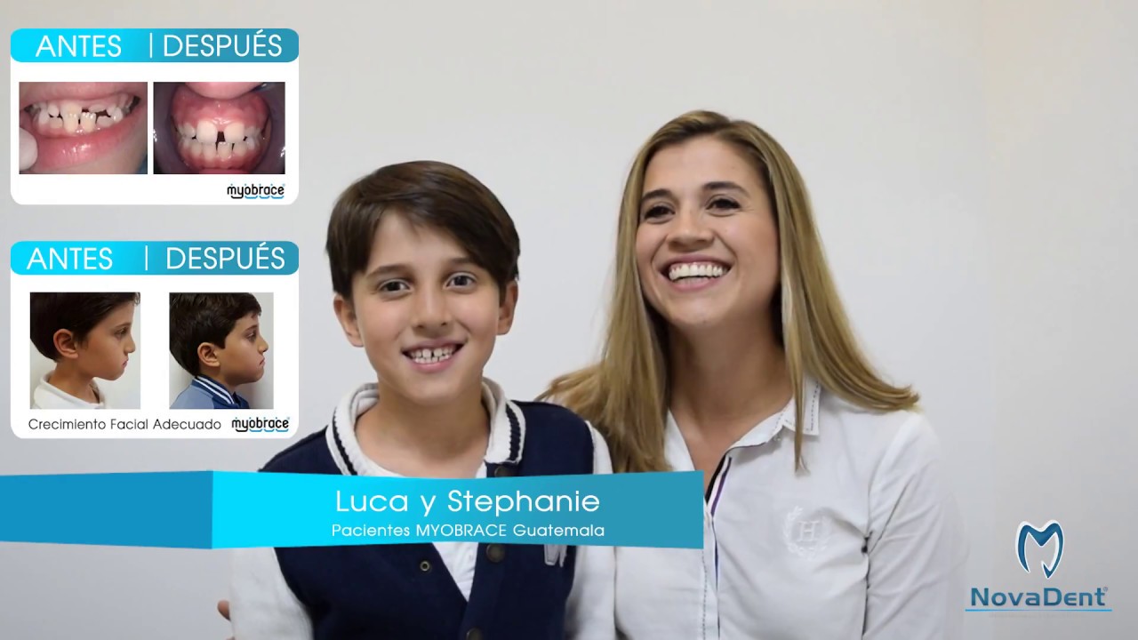 Increible Historia Myobrace Ortodoncia sin Brackets impresionante