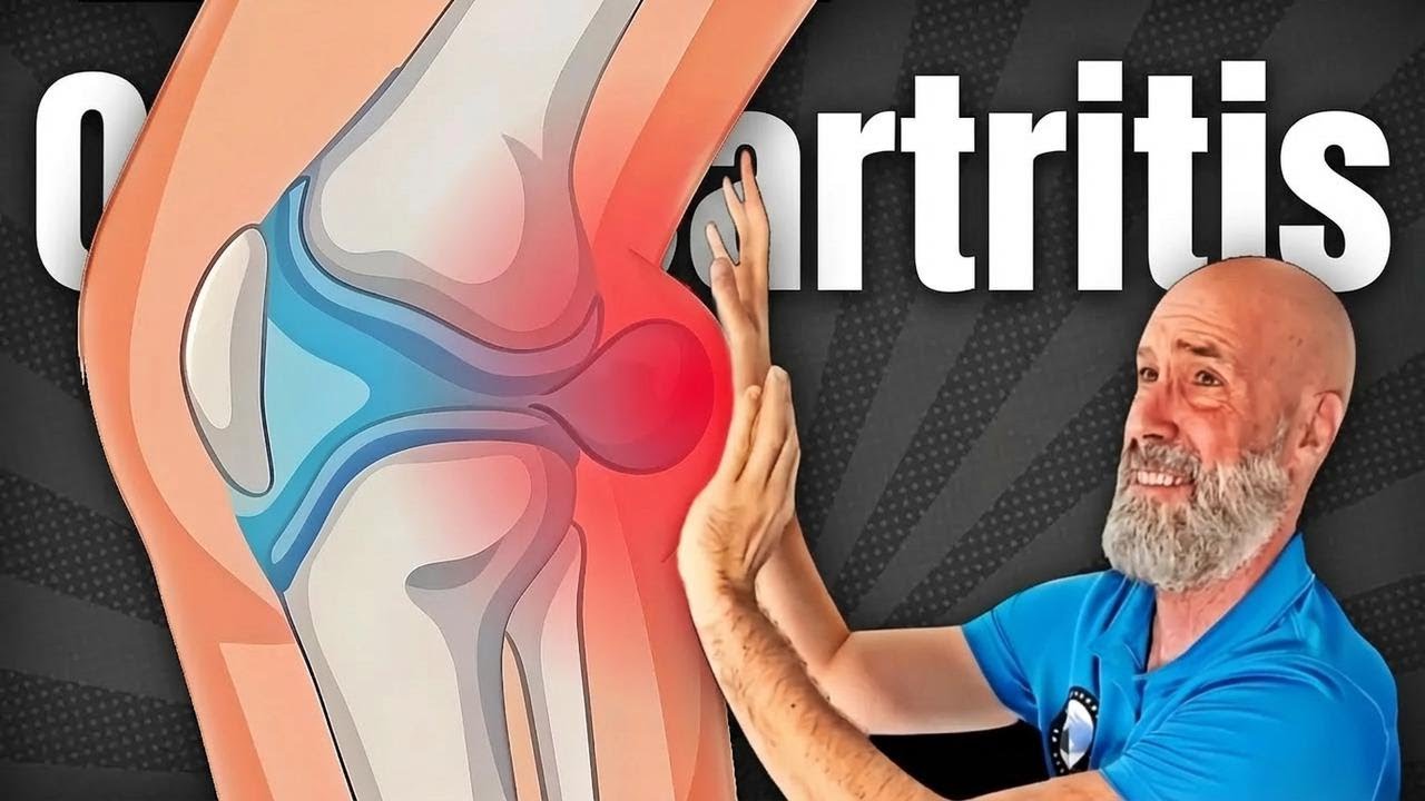 Otkrij kako ukloniti Bakerovu cistu bez operacije – 3 ključne vježbe koje pomažu!