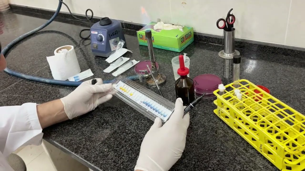 API 20E procedures