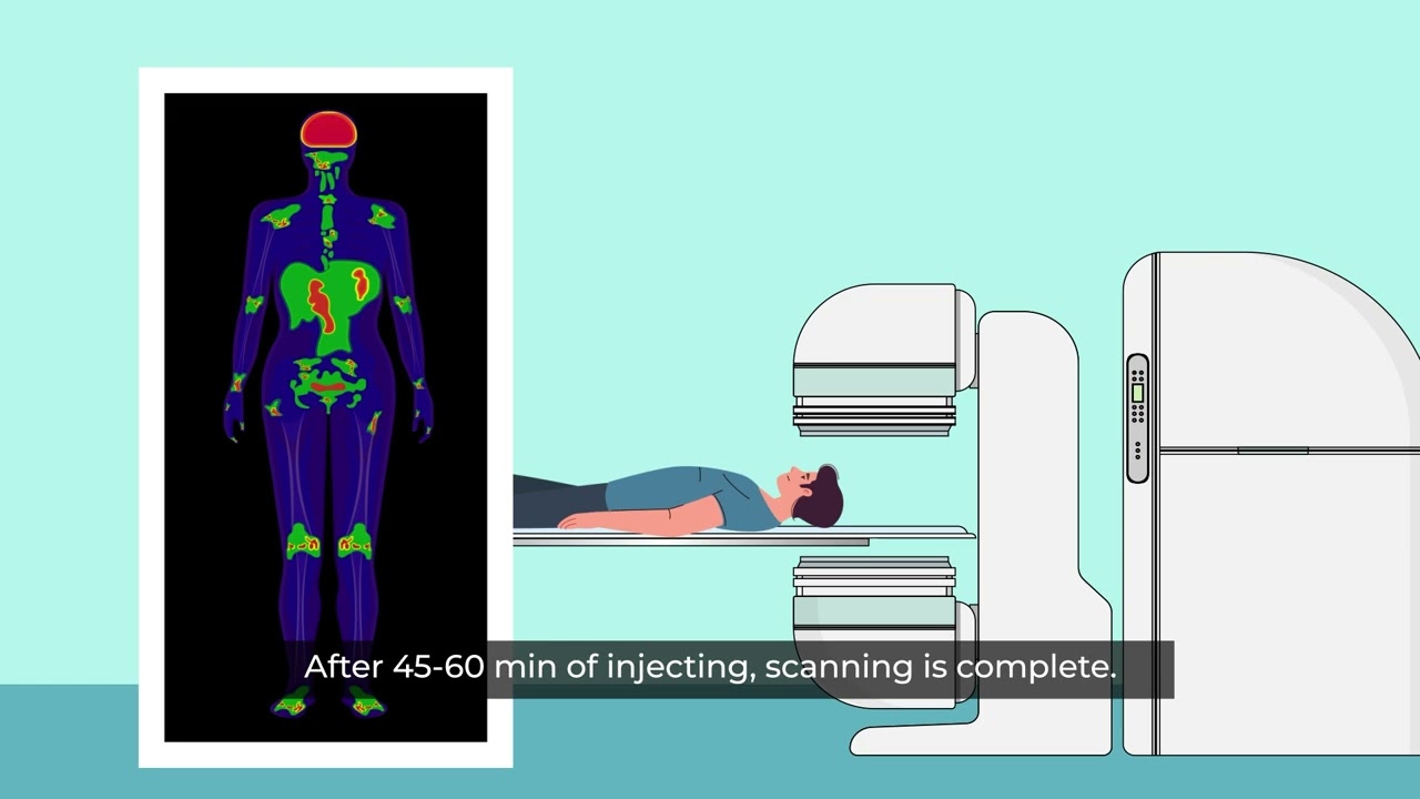 PET-CT scans Procedure Explained | Vijaya Diagnostic Centre