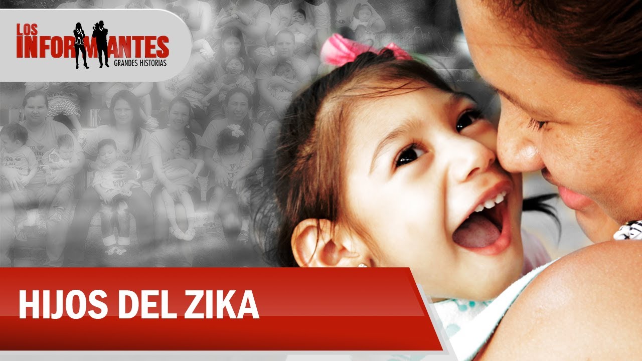 Son más de 300 niños con microcefalia que ahora forman la generación del zika - Los Informantes