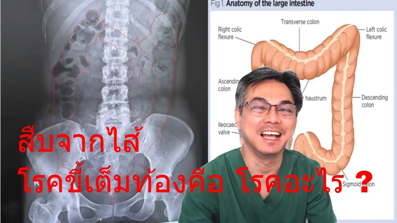 คนดังกับโรค ตอนที่ 21 : ตุ๊กตาTheVoice โรคขี้เต็มท้อง ?? มีโรคแบบนี้ด้วยหรอ ?