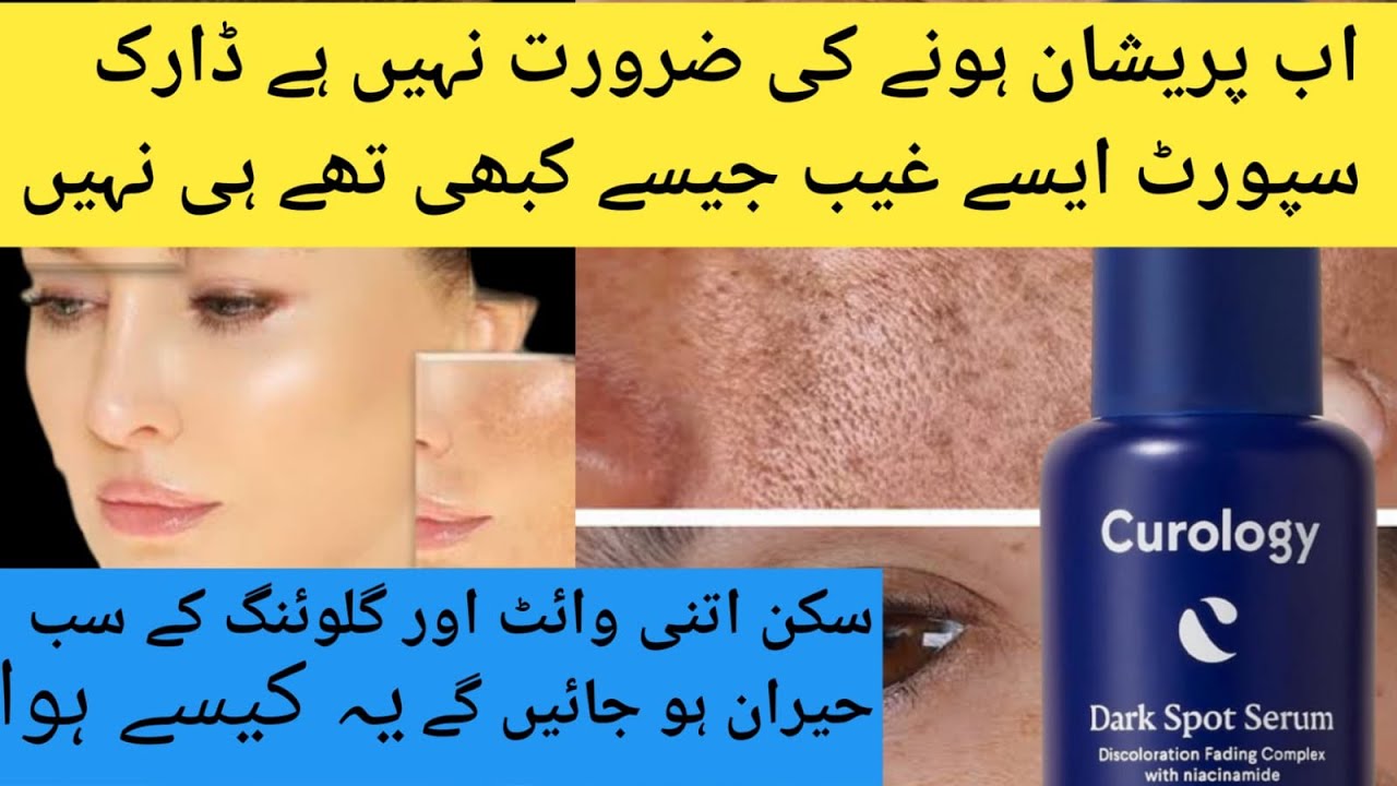Curology Dark Spot Serum, Discoloration Fading Complex with Niacinamide, Facial Serum for Post