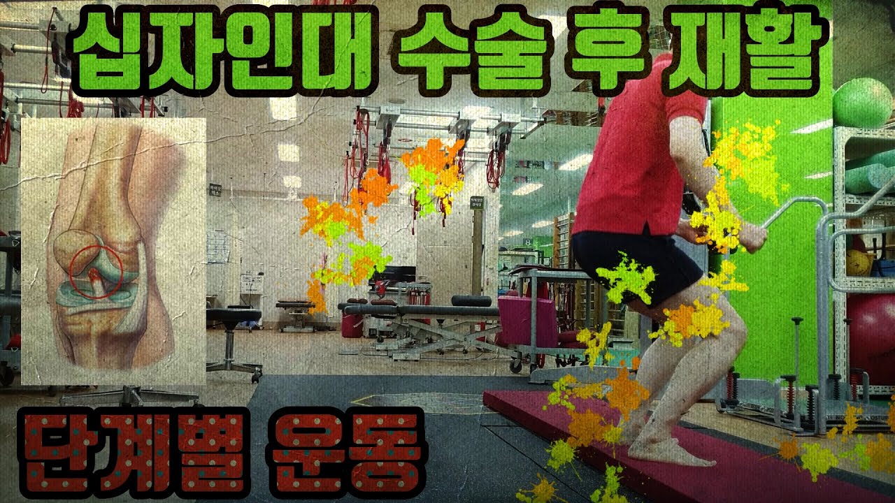 [iamPT]무릎 십자인대 수술 후 재활운동(단계별 운동)