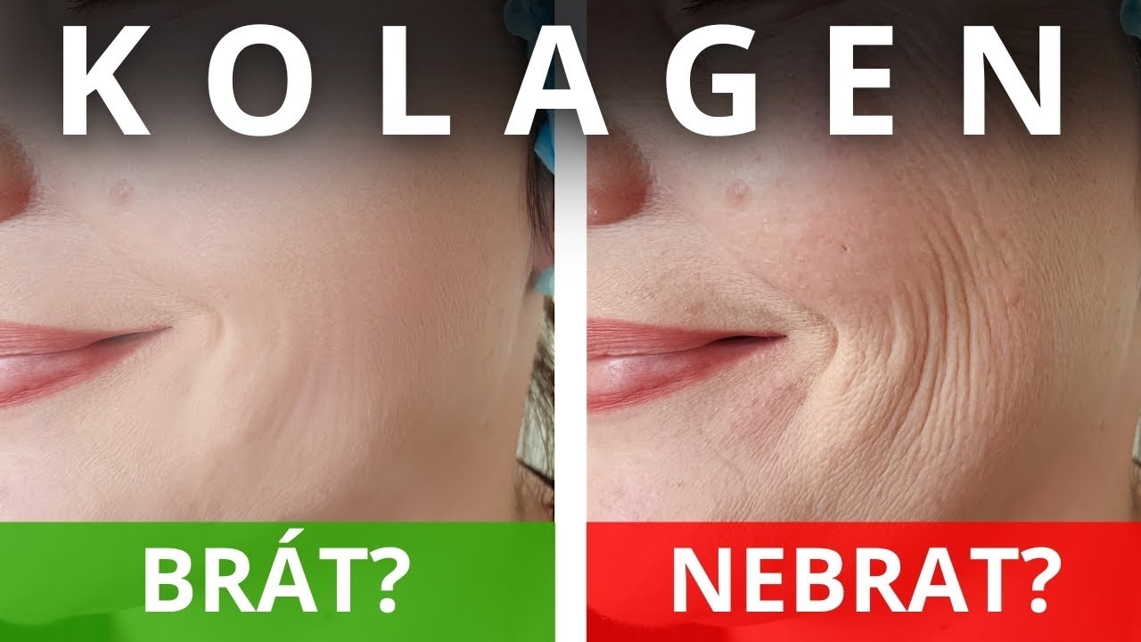 Co vám neřeknou prodejci KOLAGENU? /Jak poznat NEDOSTATEK kolagenu a co JÍST pro jeho tvorbu?