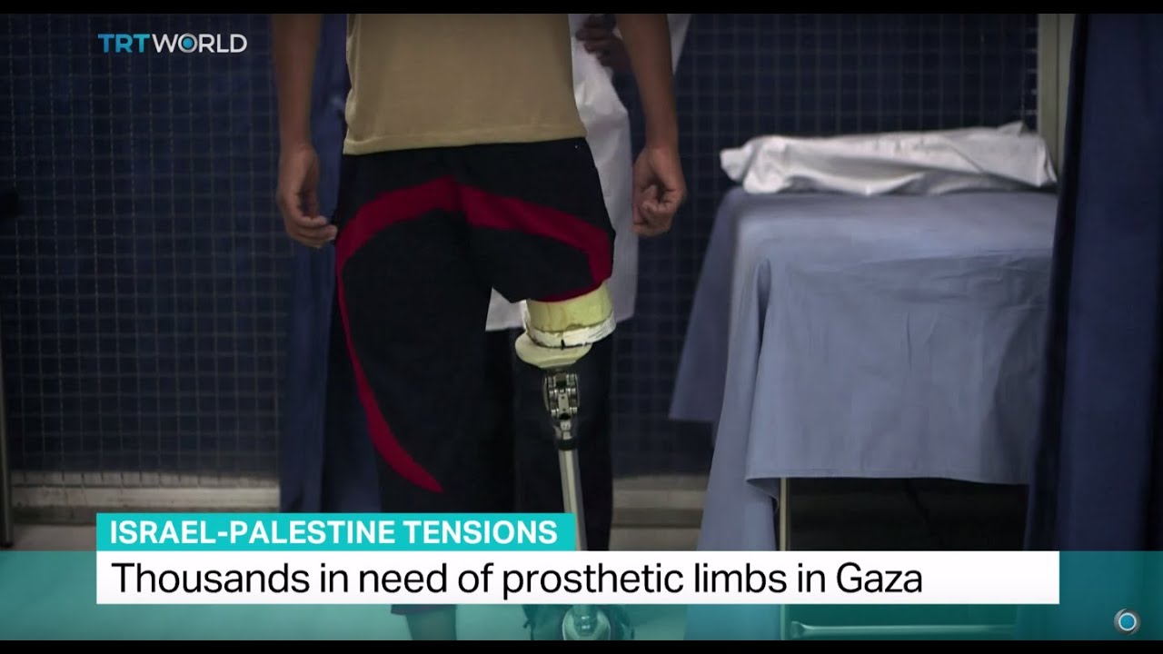 Israel-Palestine Tensions: Thousands in need of prosthetic limbs in Gaza