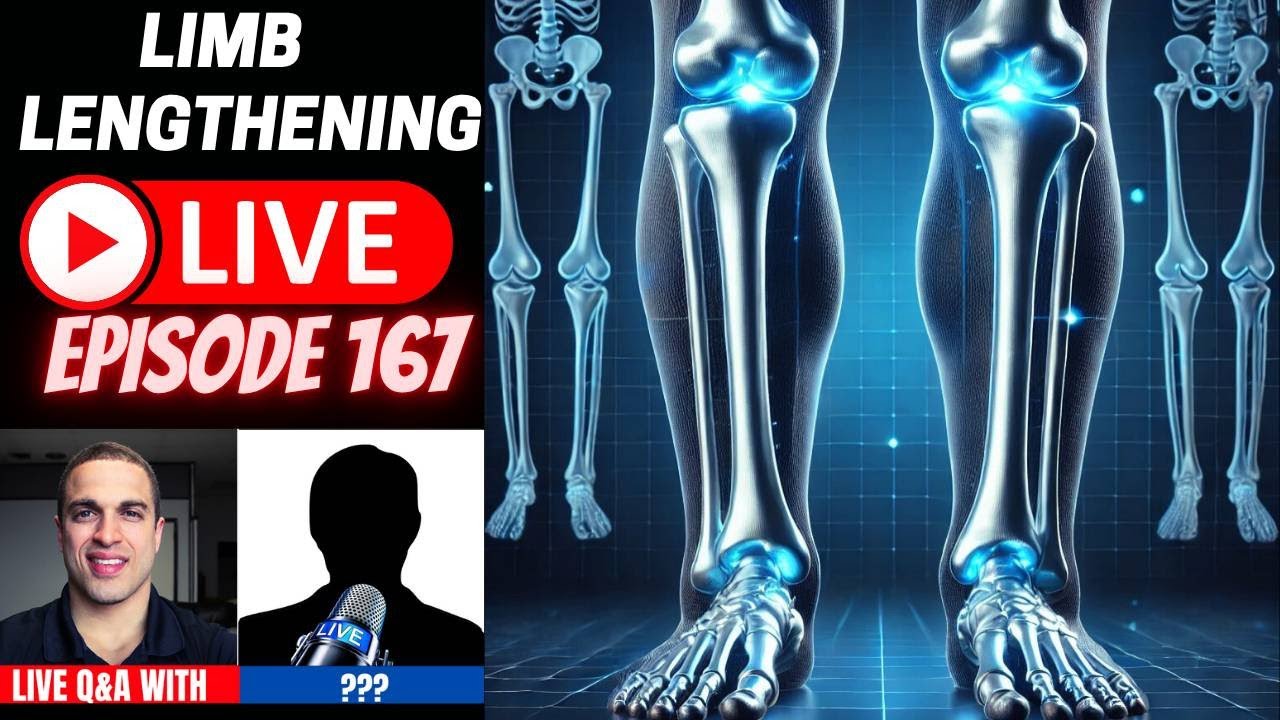 Limb Lengthening LIVE Episode 167 - Deciding which Limb Segment to Lengthen