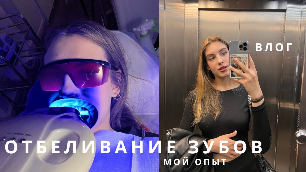 Клиническое отбеливание зубов | Ощущения во время процедуры, результат
