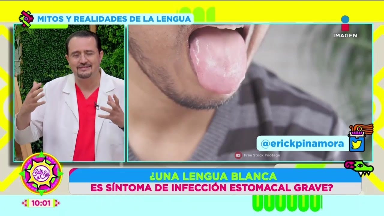 ¿Sentir la lengua escaldada es síntoma de hipertiroidismo? | Mitos y Realidades | Sale el Sol
