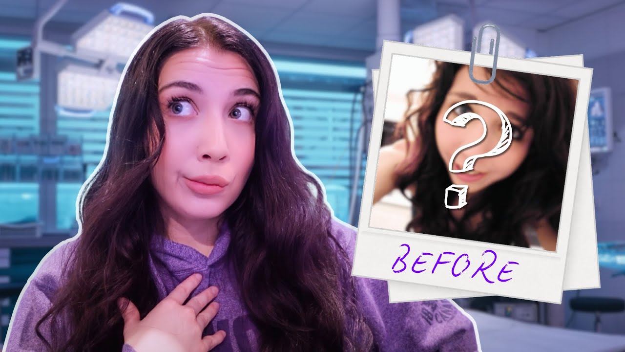 Coming Clean About My Secret Plastic Surgery
