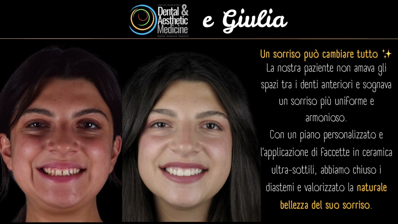 Come cambia un sorriso: casi reali di estetica dental