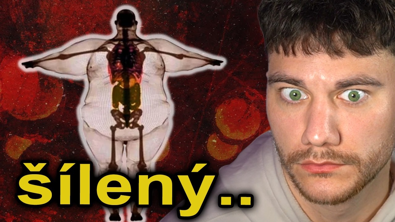 &Scaron;OKUJ&Iacute;C&Iacute; &Uacute;ČINKY OBEZITY NA TV&Eacute; TĚLO..