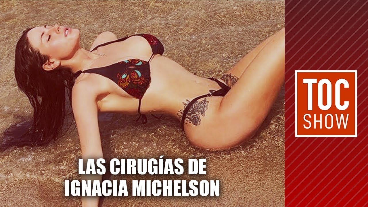 Las cirugías de Ignacia Michelson | TOC SHOW 2019