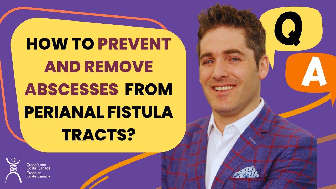 How To Prevent and Remove Abscesses from Perianal Fistula Tracts?