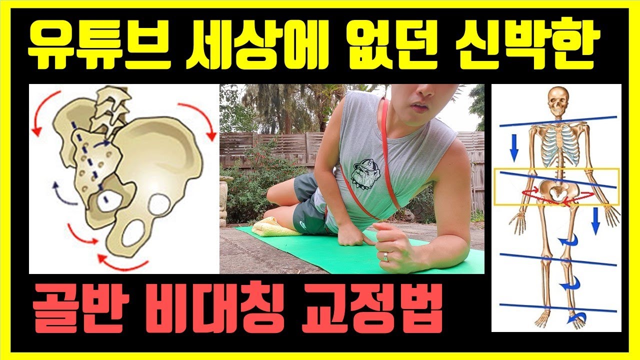 골반비대칭 교정 운동 by 호주물리치료사: 골반 좌우 틀어짐 교정의 필수조건