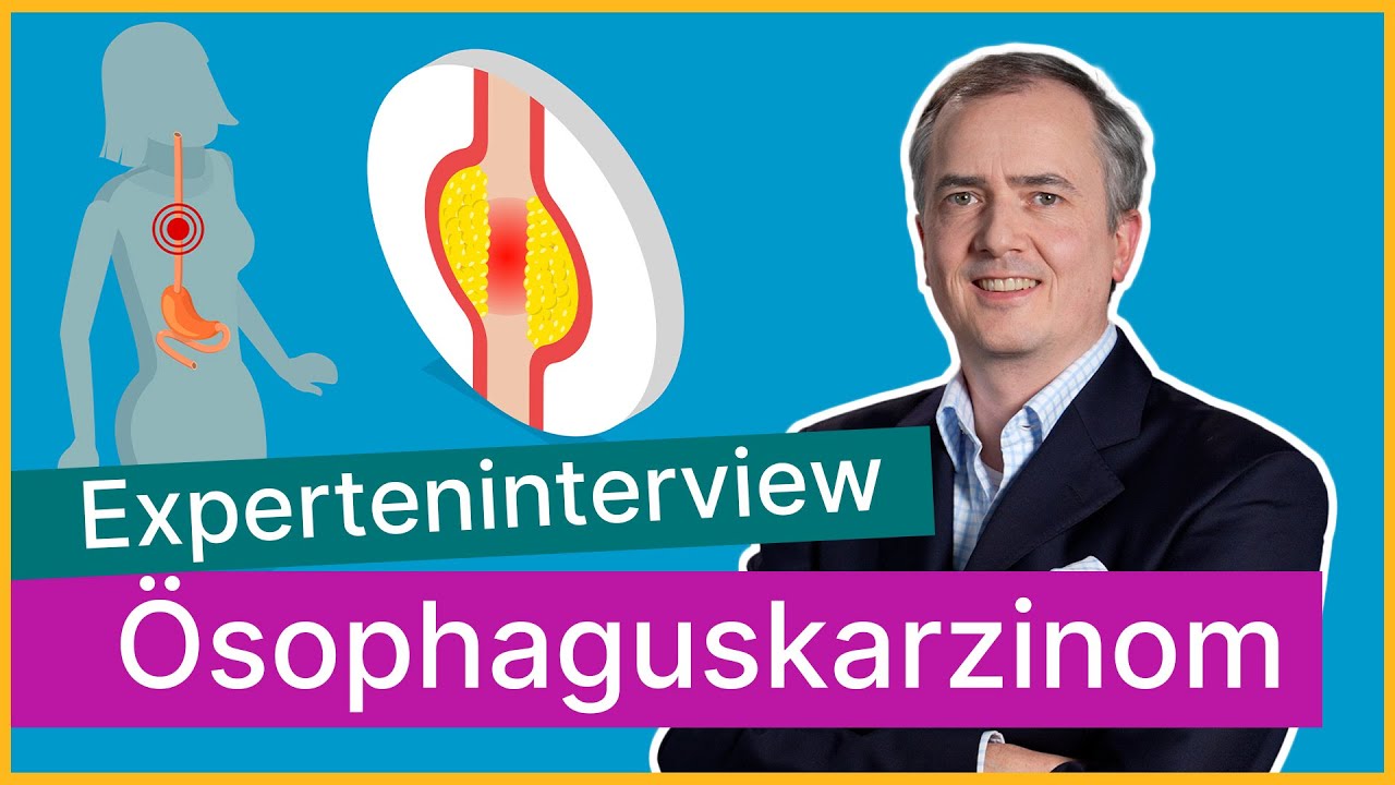 Diagnose Speiseröhrenkrebs – wie geht es weiter? | Asklepios