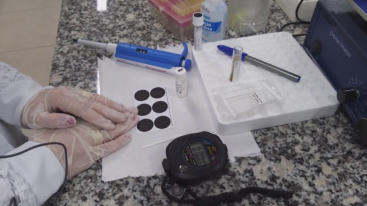 ANTIESTREPTOLISINA O (ASO)