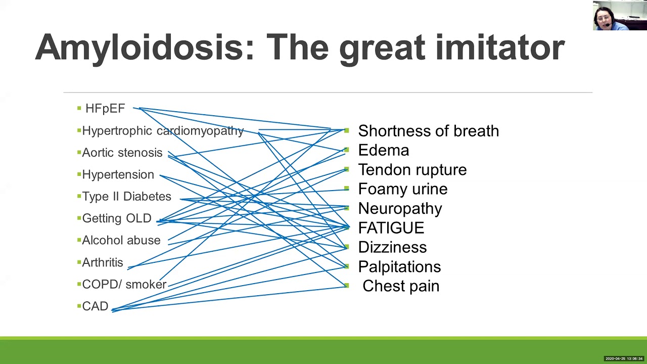 Renal Amyloidosis with Q&A