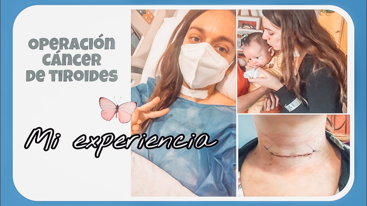 Operación de Tiroides - Nódulo cancerígeno 🦋 mi experiencia || Steph Elizondo