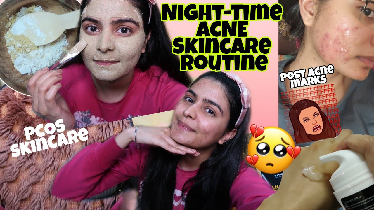 Night Time Acne-Skin Routine for  Acne Marks & Scars  #NotSponsered | Kashika Chauhan