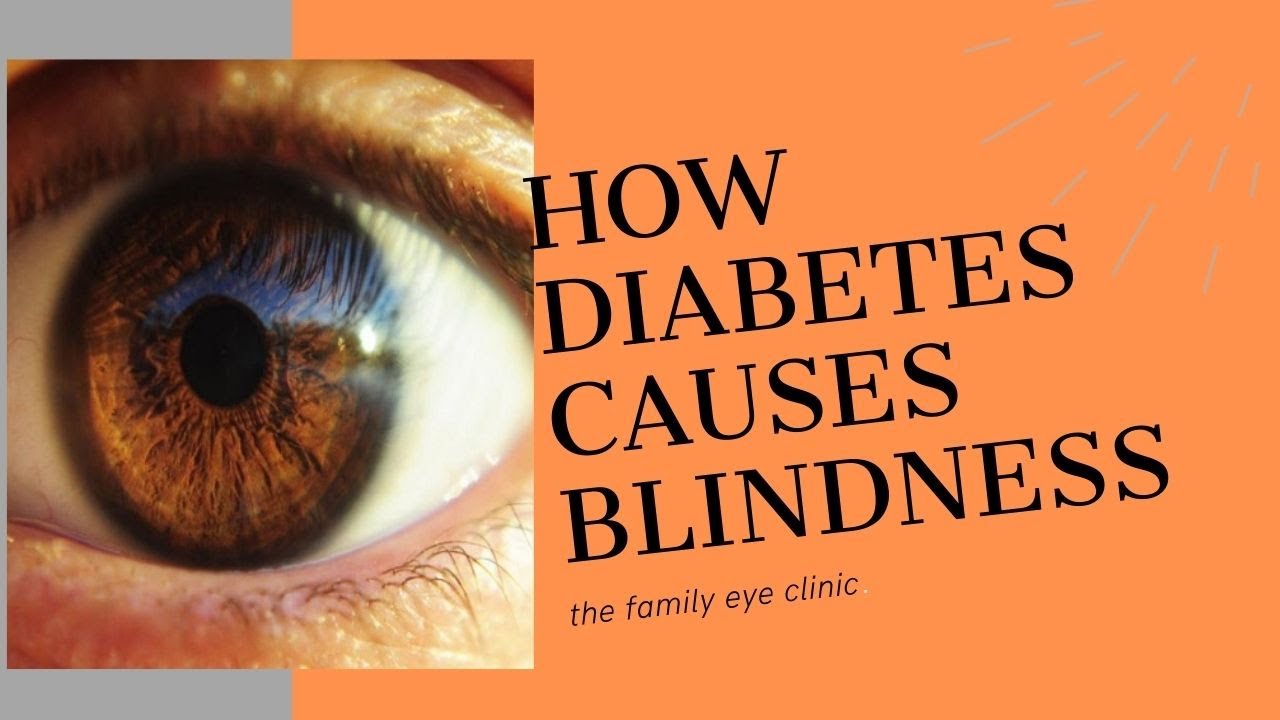 How Diabetes affects eye sight
