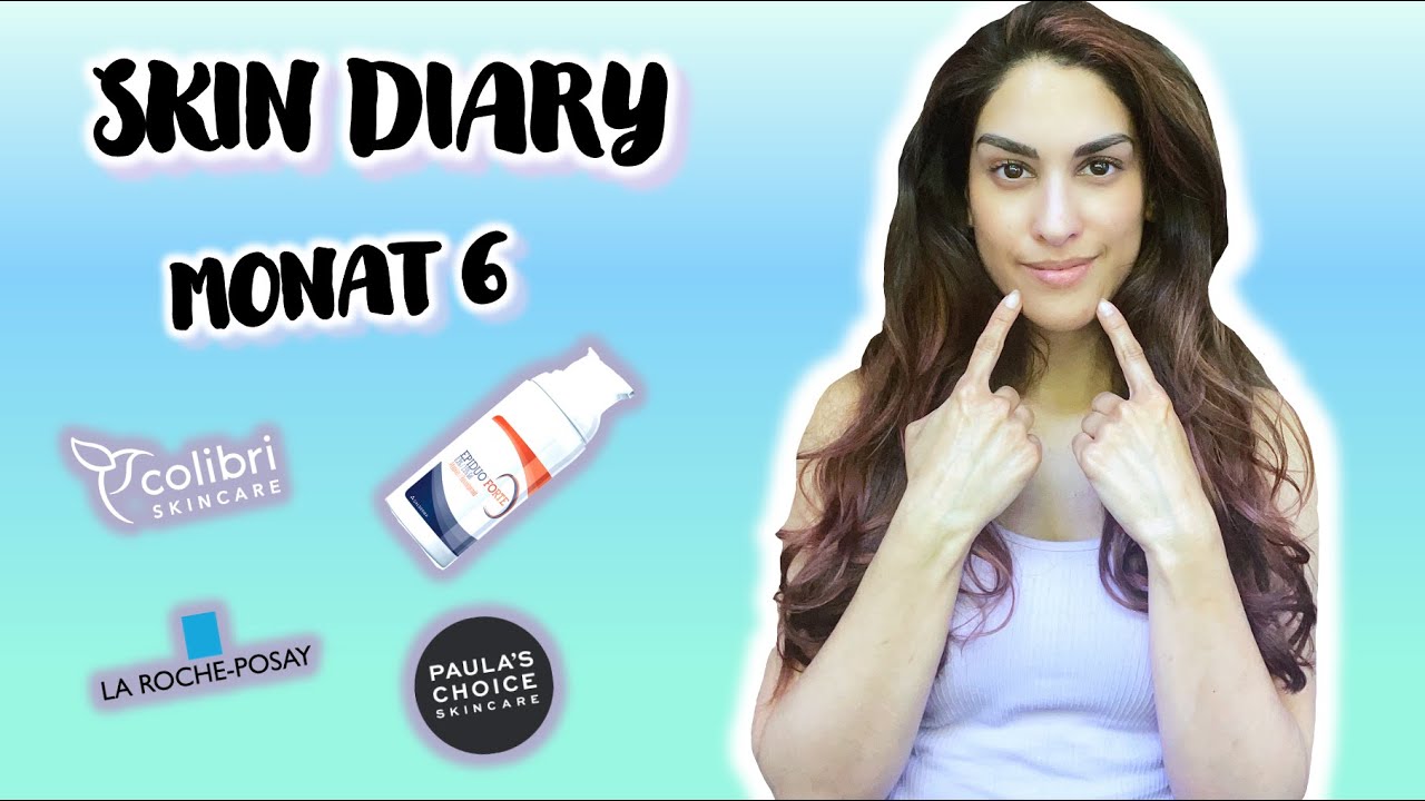 SKIN DIARY MONAT 6💙 Der erste Monat mit Epiduo Forte Gel 😮 | Angela Mel