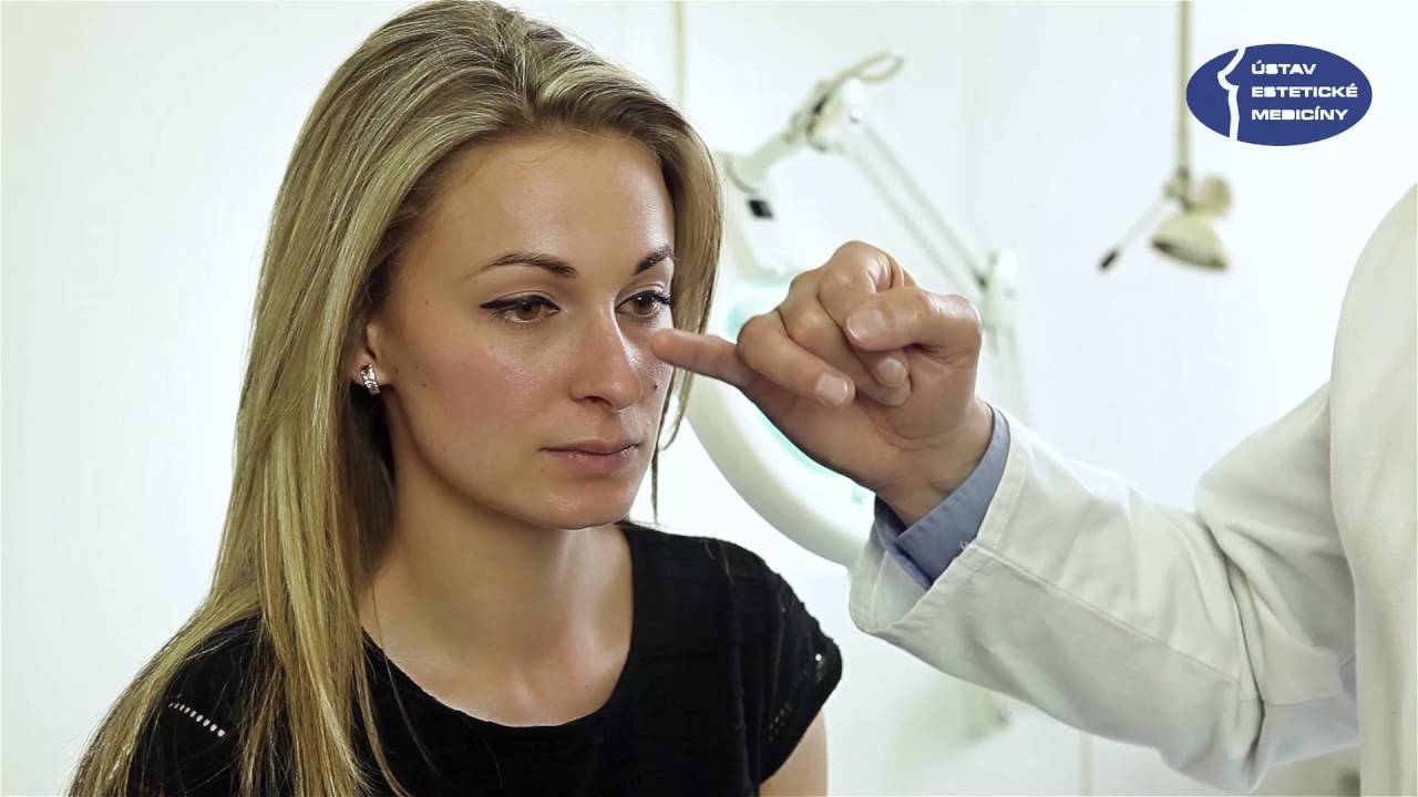 Odstraněn&iacute; dlahy nosu po rhinoplastice &ndash; MUDr. Z&aacute;ruba, &Uacute;stav estetick&eacute; medic&iacute;ny