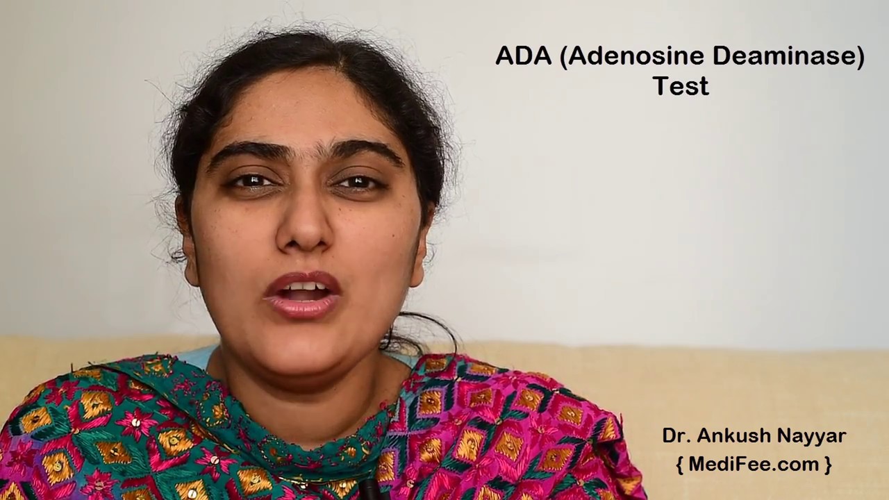 ADA (Adenosine Deaminase) Test - Procedure and Use  in Diagnosis of Tuberculosis