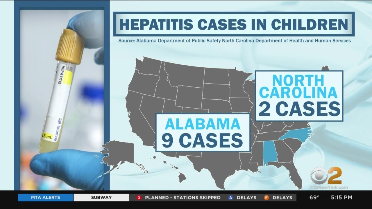 CDC issues health alert for cluster of Hepatitis cases in children