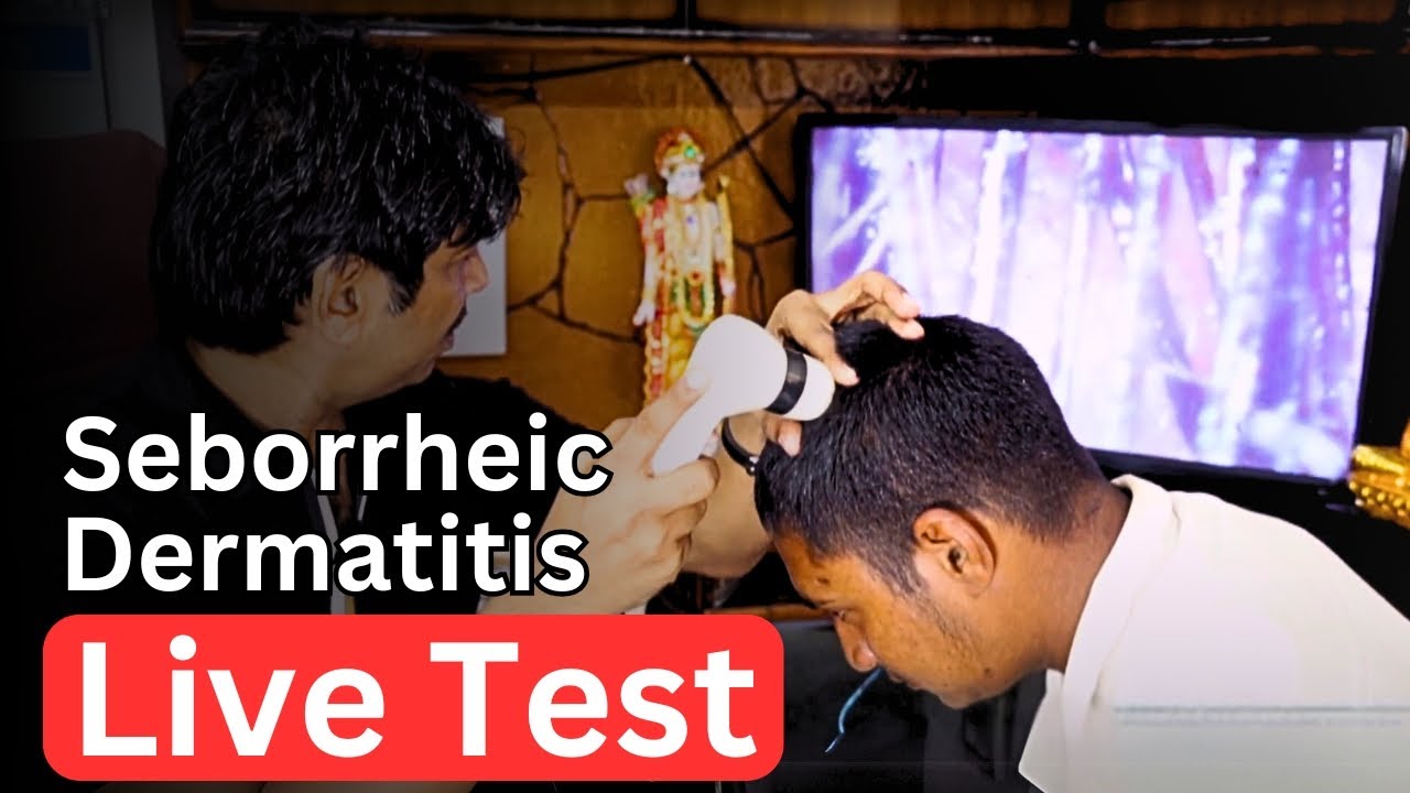 Jaybeer’s Fight Against Seborrheic Dermatitis | From Shivpuri to VHCA: