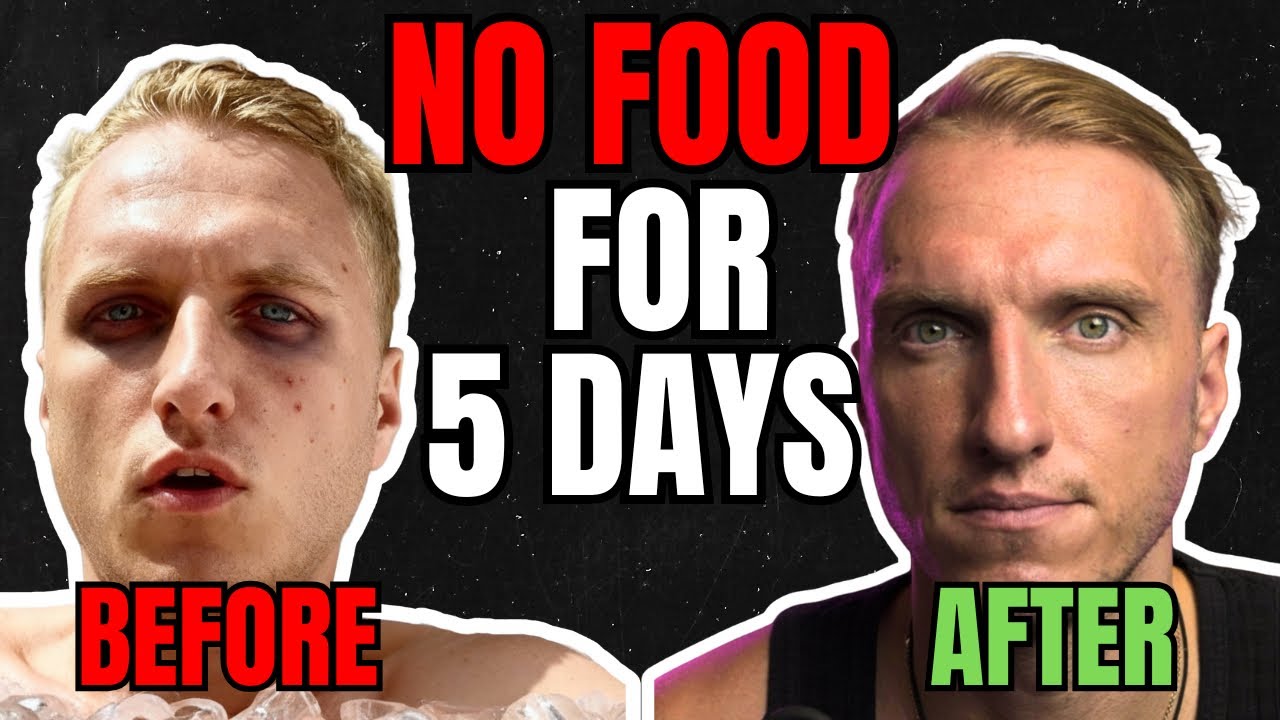 5 DAY WATER FAST - NO FOOD! [before & after | complete guide]