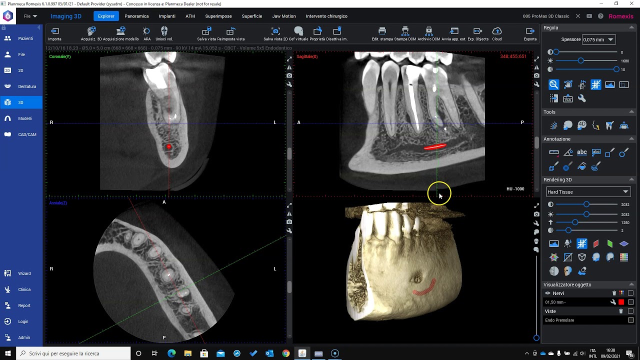 Modalità endodontica