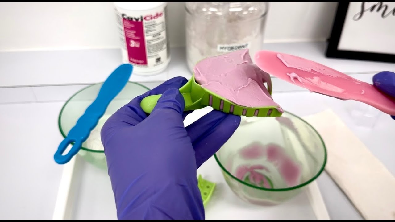 Dental Impressions Step by Step