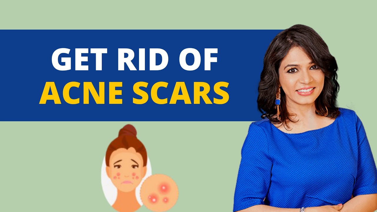How to get rid of acne scars? | Answers Dr. Jaishree Sharad